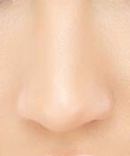 Nasenkorrektur Basel Nasenoperation Rhinoplastik Nasenspezialist Nasenkorrektur Basel Nasenoperation Rhinoplastik Nasenspezialist